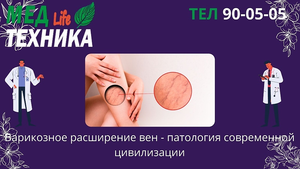 Варикозное расширение вен - патология современной цивилизации