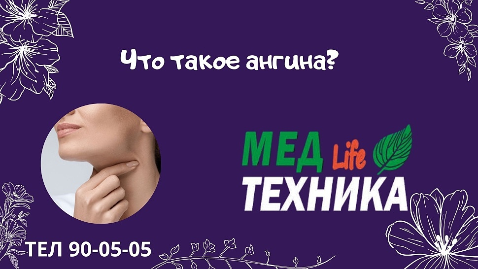 Что такое ангина?