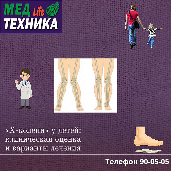 «X-колени» у детей: клиническая оценка и варианты лечения