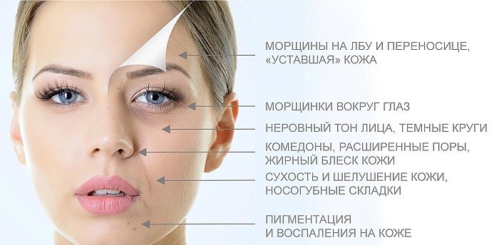 Ультразвуковая очистка кожи лица.