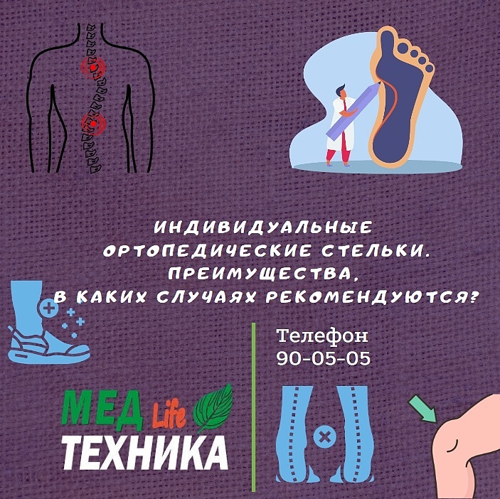 Индивидуальные ортопедические стельки. Преимущества, в каких случаях рекомендуются?