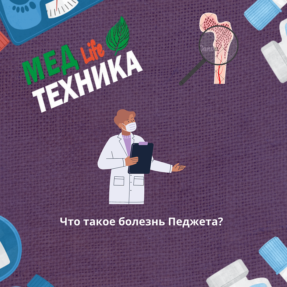 Что такое болезнь Педжета?