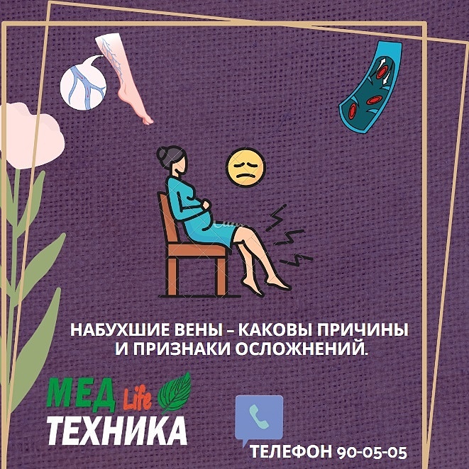 Набухшие вены – каковы причины и признаки осложнений?