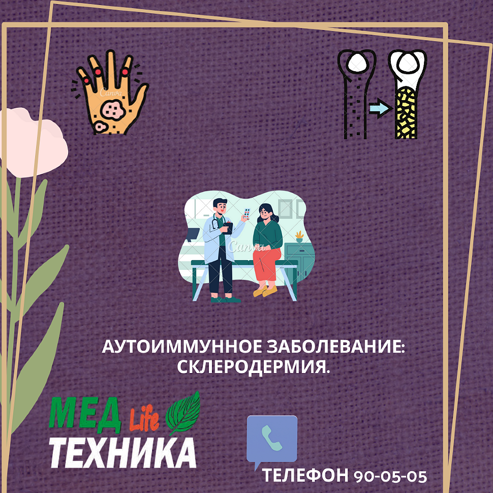 Аутоиммунное заболевание: Склеродермия.