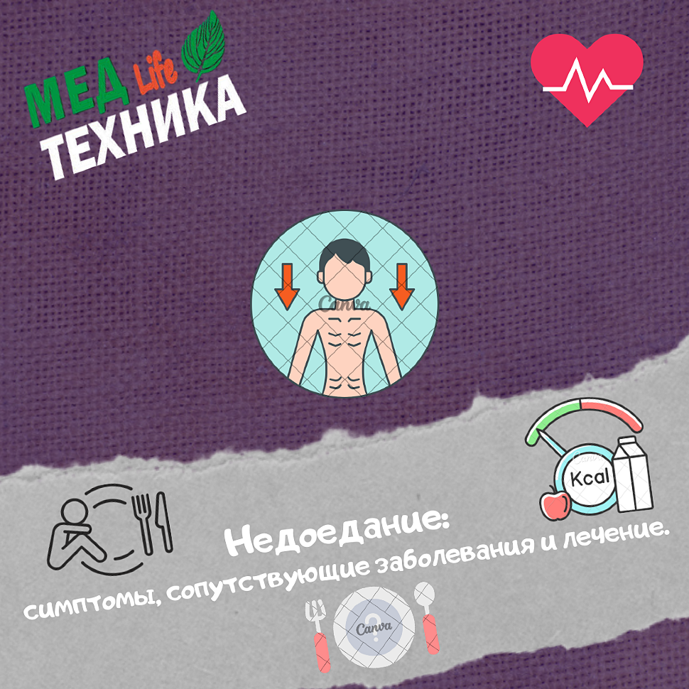 Недоедание: симптомы, сопутствующие заболевания и лечение.