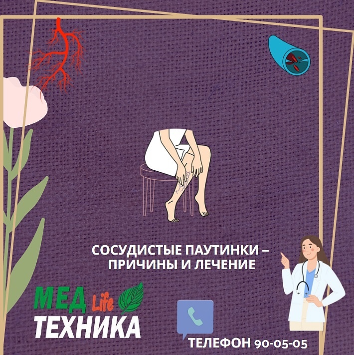 Сосудистые паутинки на теле — причины и лечение.