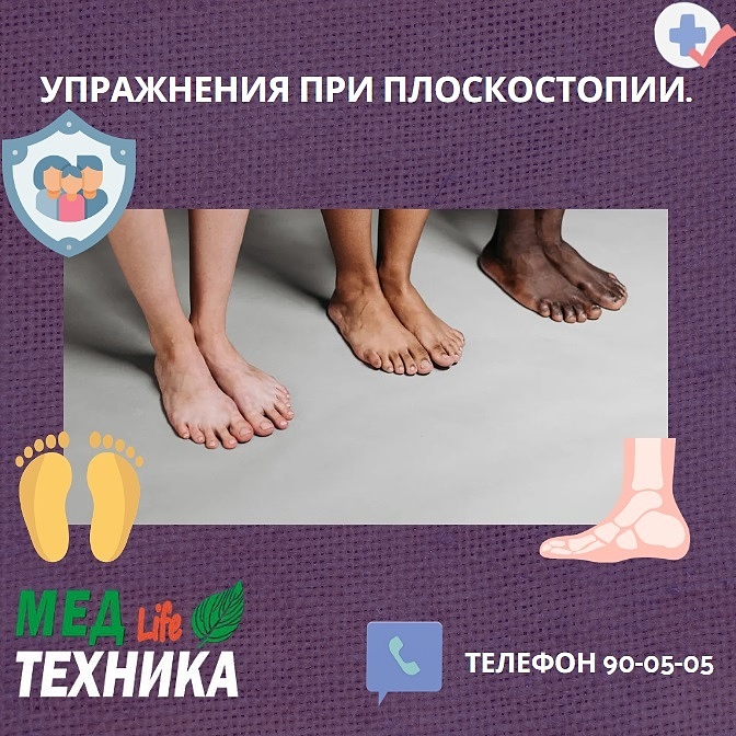 Упражнения при плоскостопии.