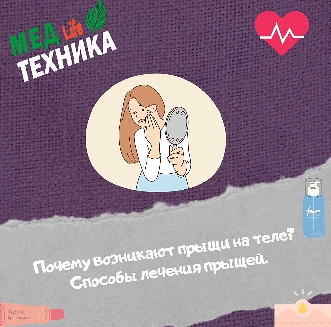 Почему возникают прыщи на теле? Способы лечения прыщей.
