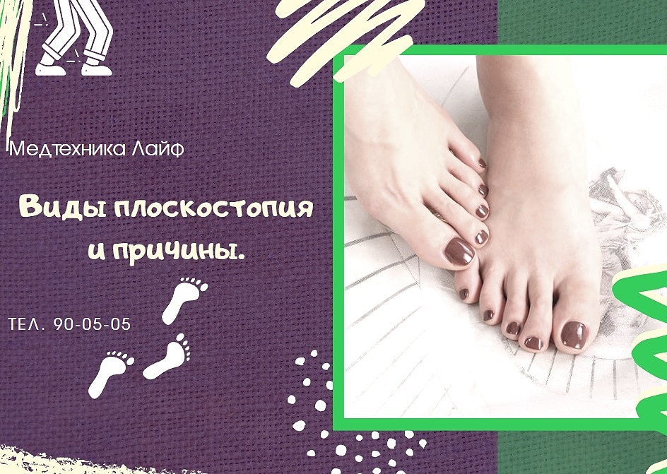 Виды плоскостопия и причины.