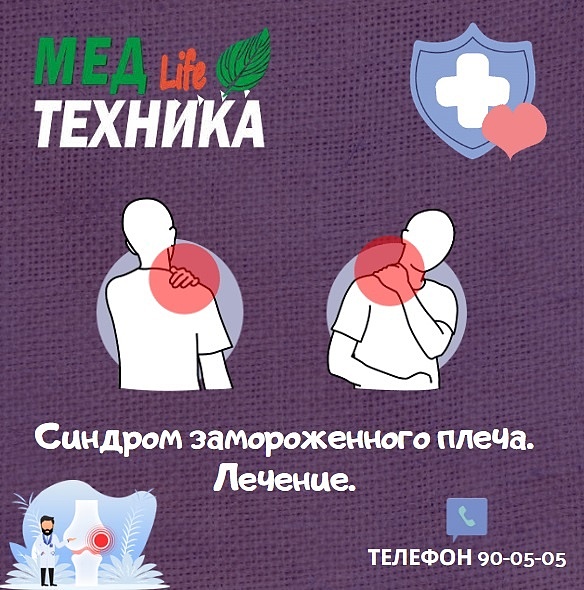 Синдром замороженного плеча. Лечение.