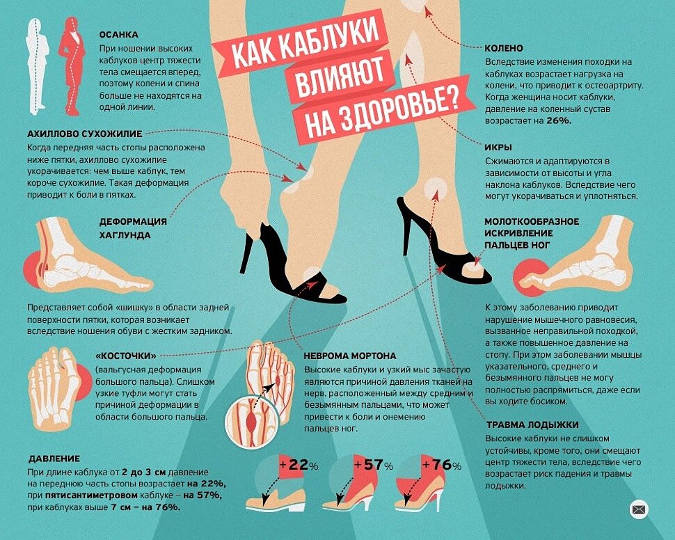 Влияние каблуков на здоровье.