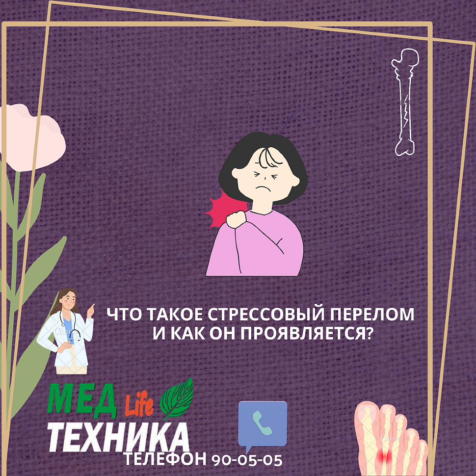 Что такое стрессовый перелом и как он проявляется?