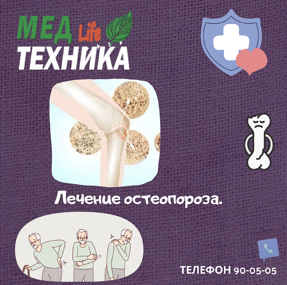 Лечение остеопороза.