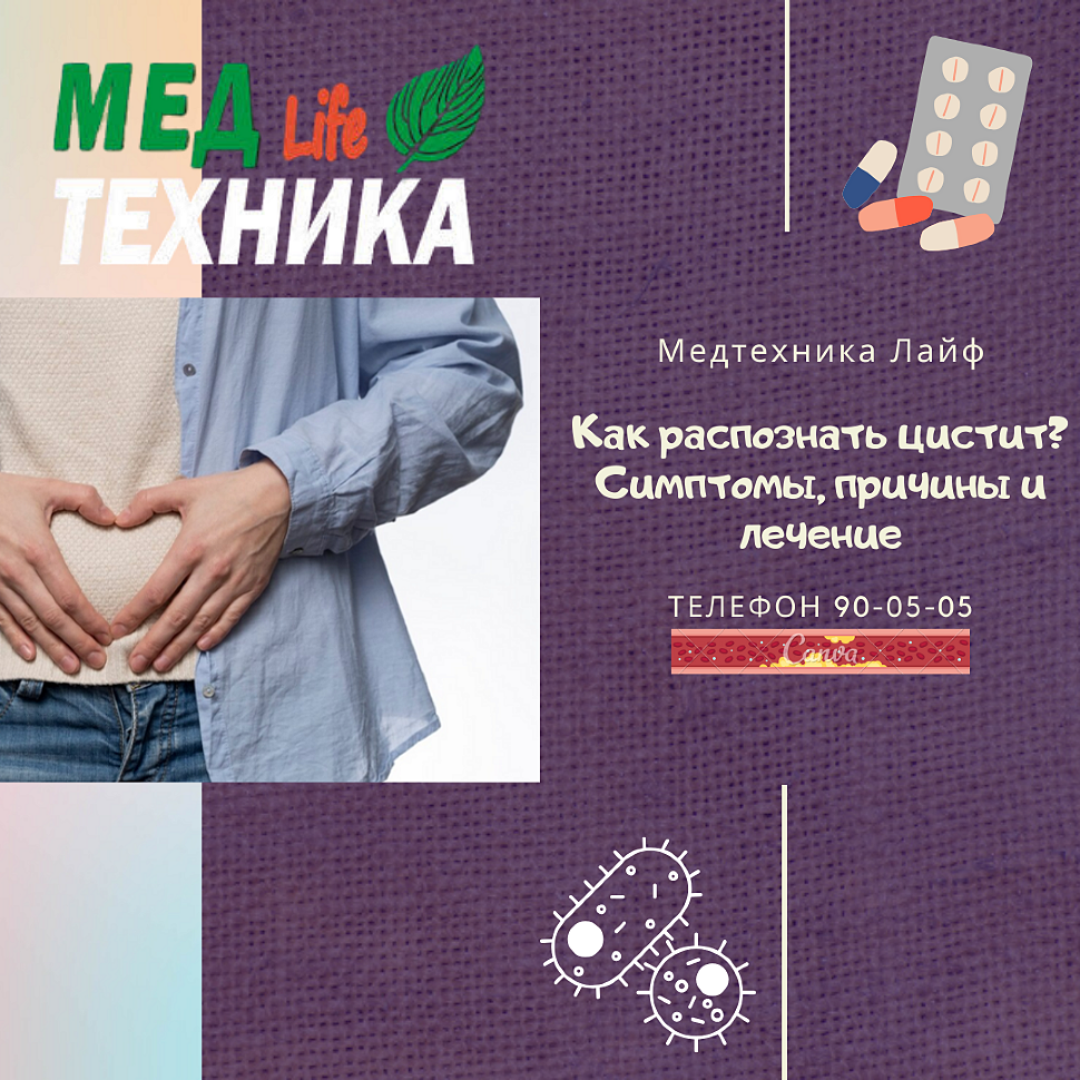 Как распознать цистит? Симптомы, причины и лечение