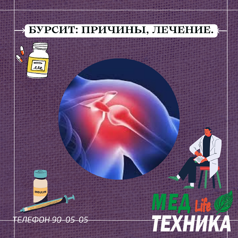 Бурсит: причины, лечение.
