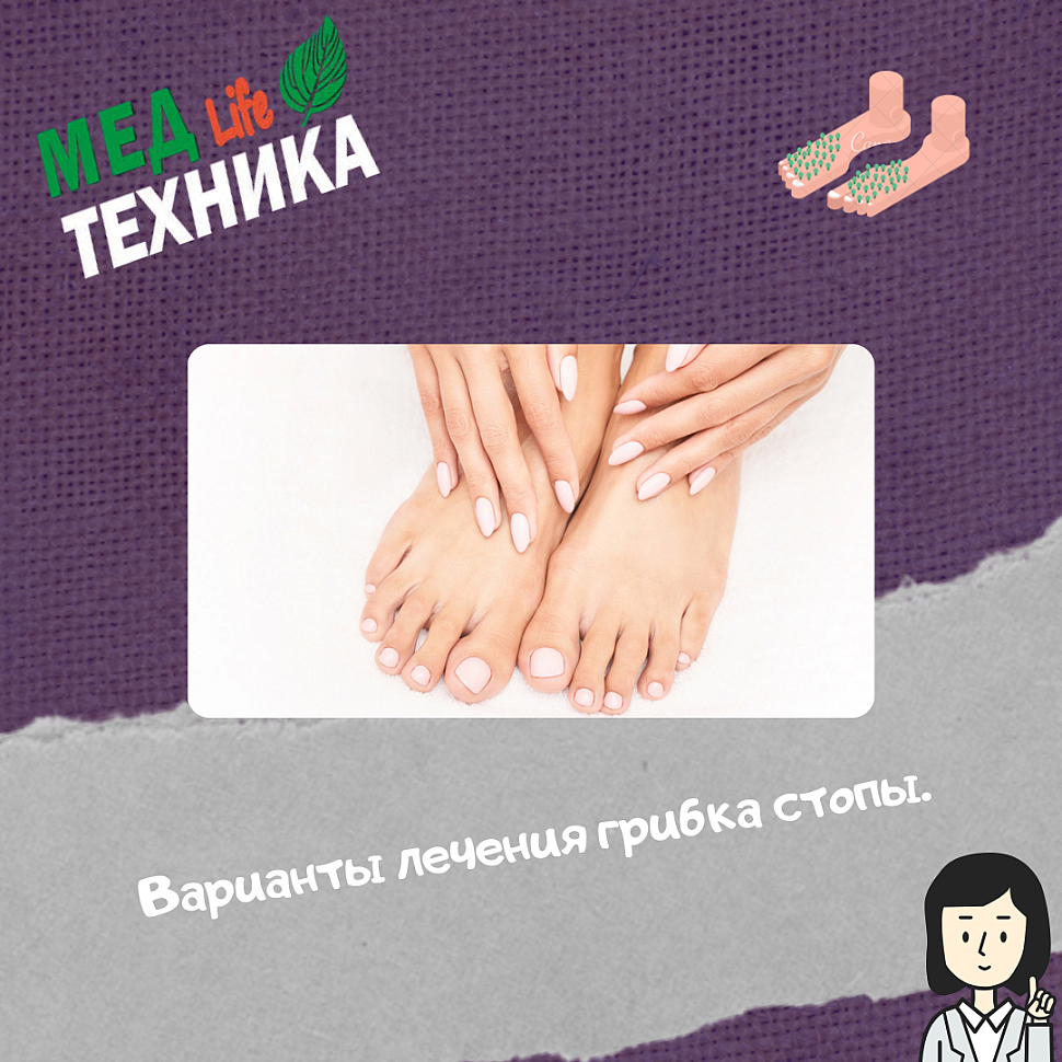 Варианты лечения грибка стопы.