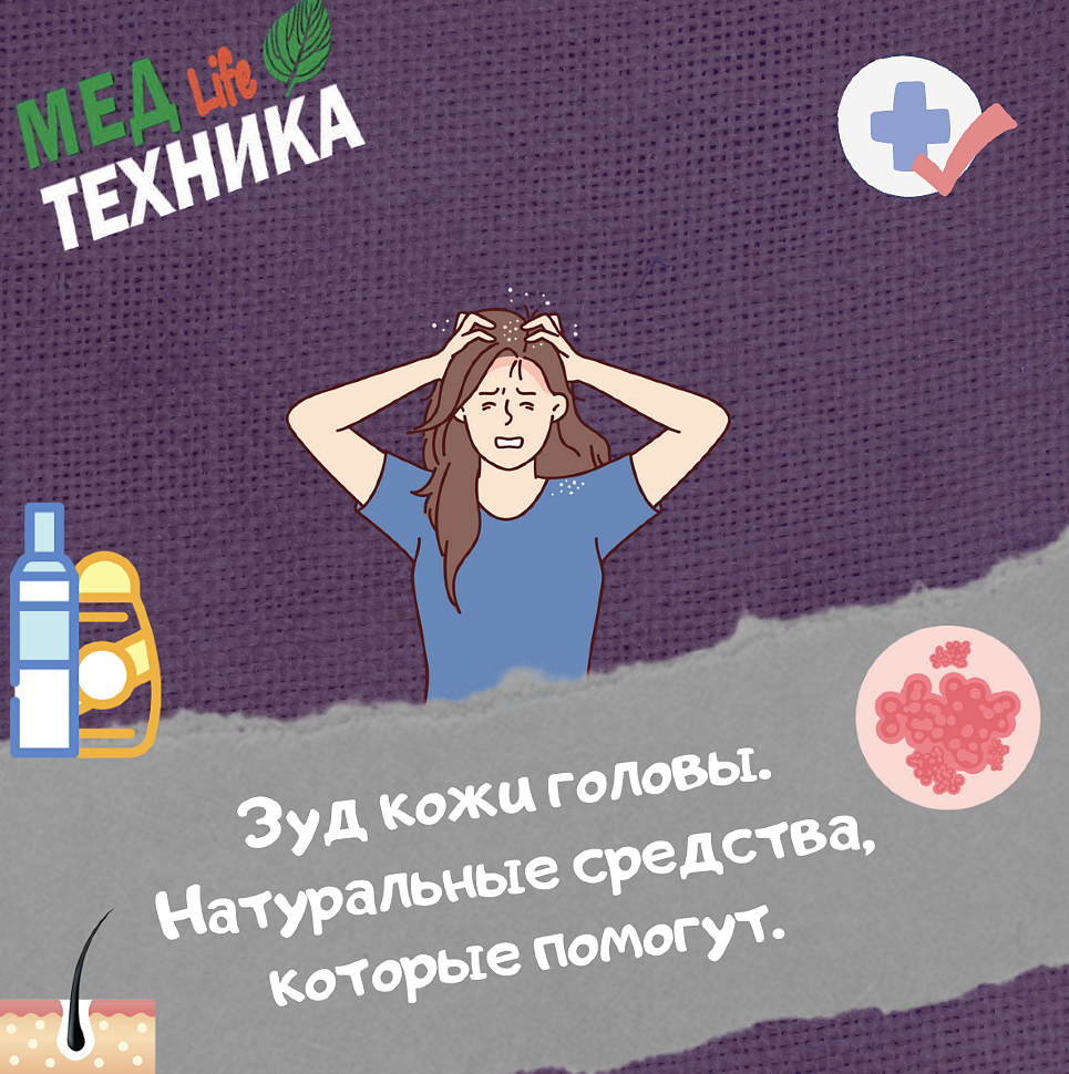 Зуд кожи головы. Натуральные средства, которые помогут.