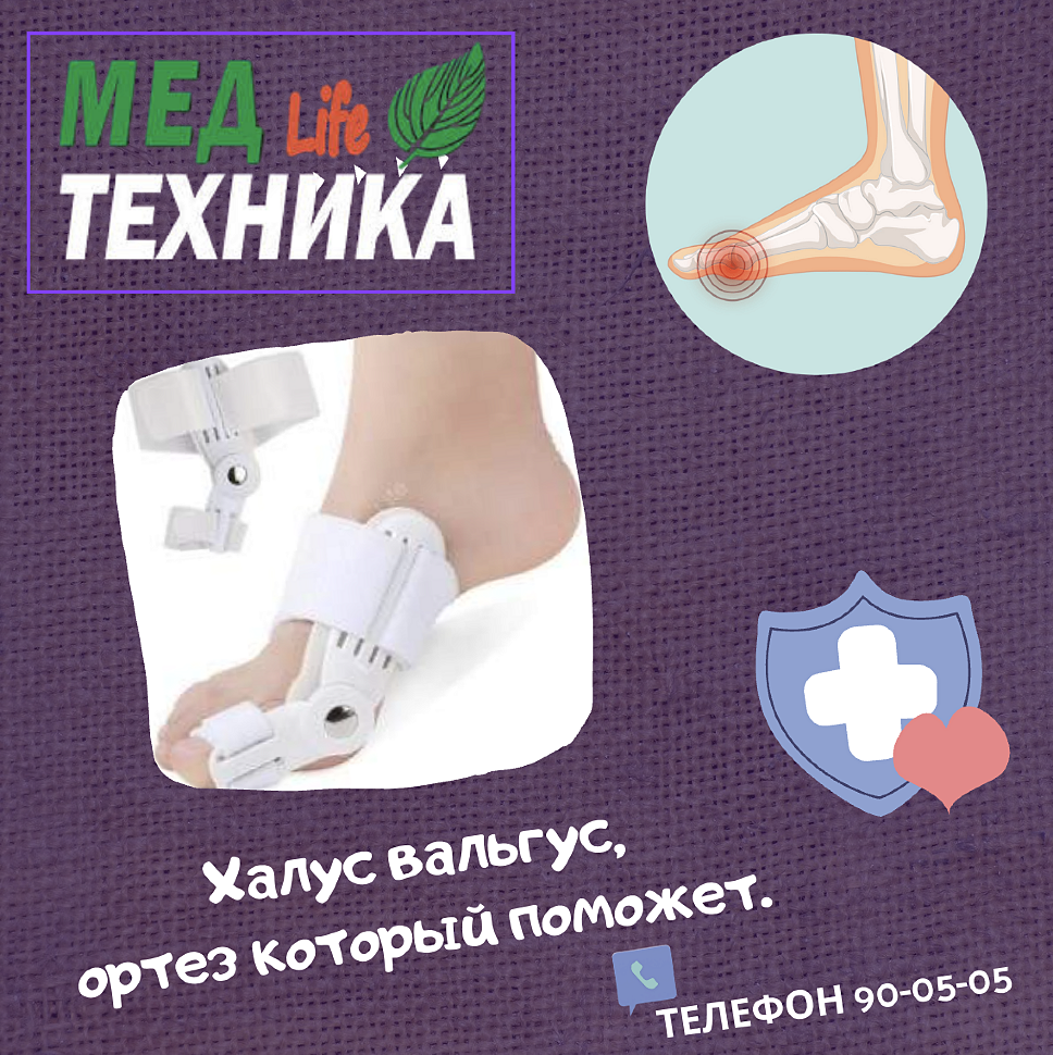 Халюс вальгус, ортез который поможет.