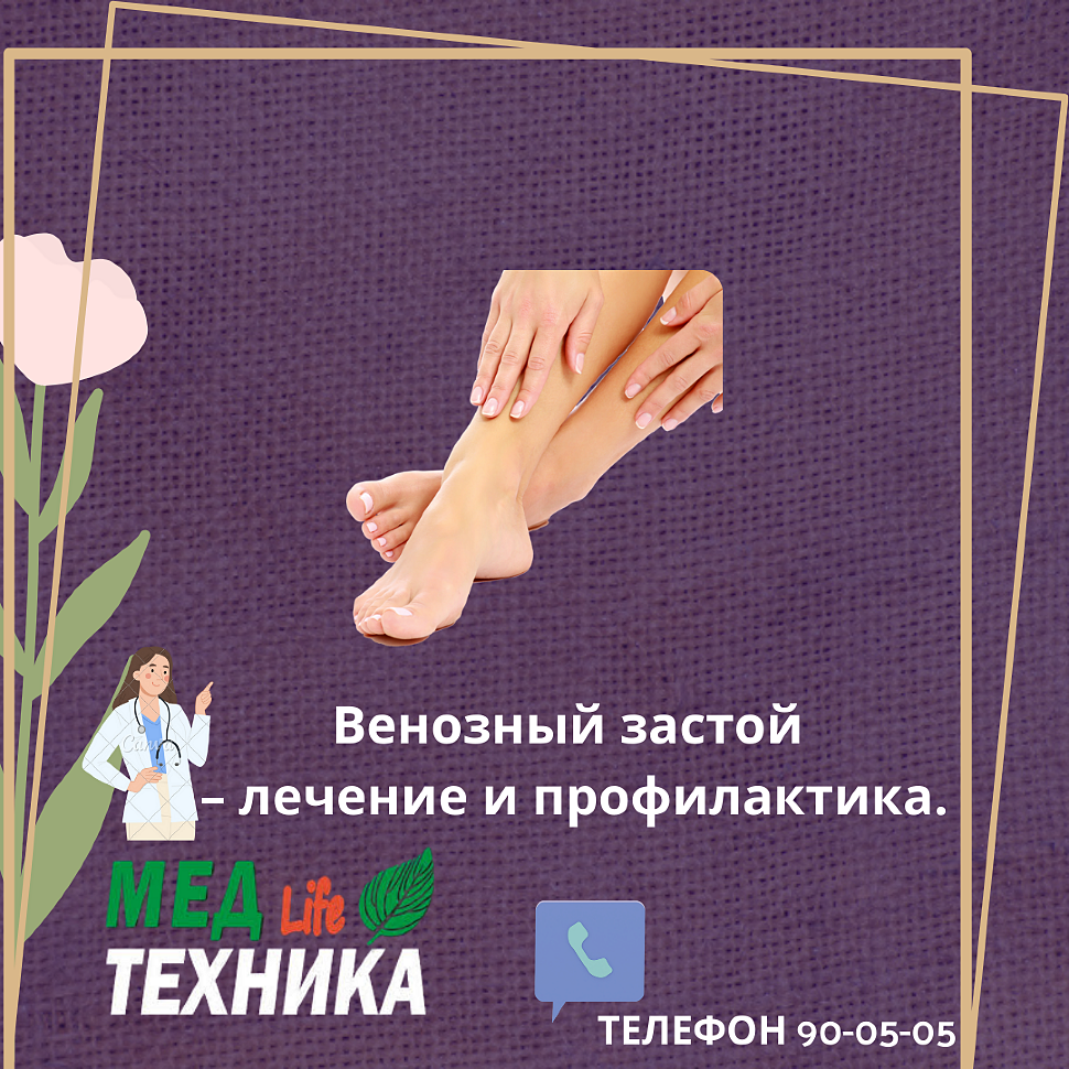 Венозный застой – лечение и профилактика.