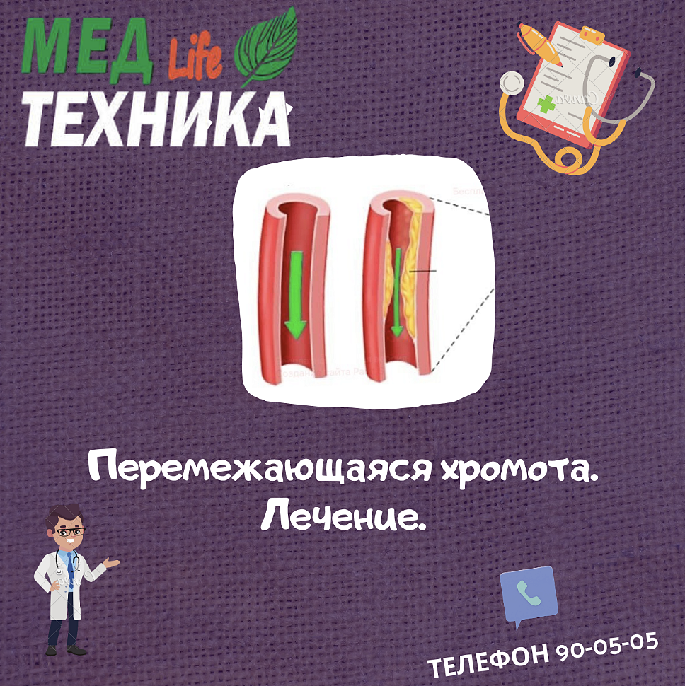 Перемежающаяся хромота. Лечение.