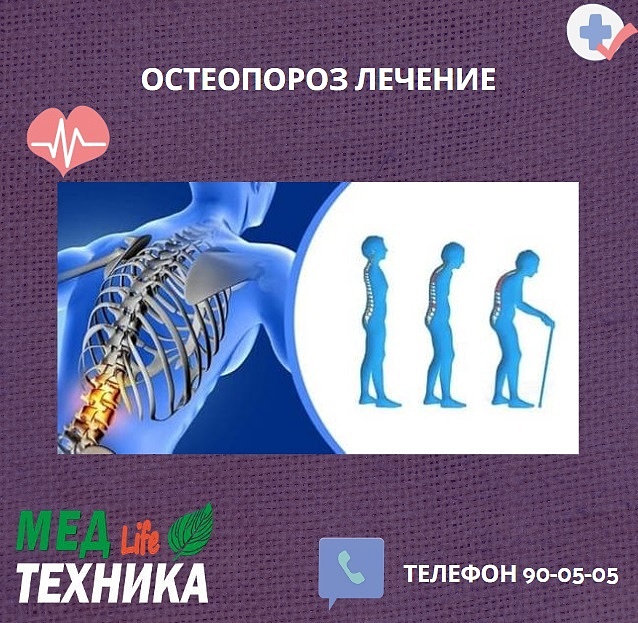 Остеопороз лечение