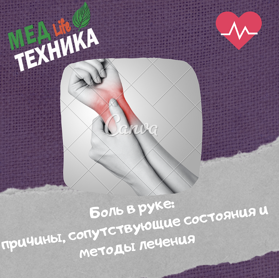 Боль в руке: причины, сопутствующие состояния и методы лечения