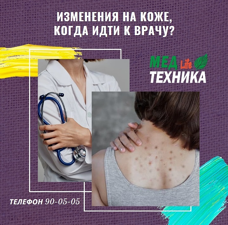Изменения на коже, когда идти к врачу?