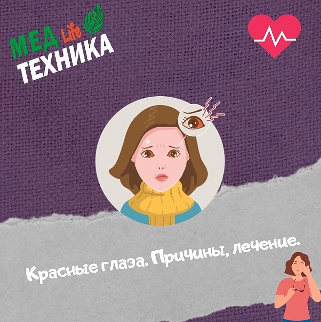 Красные глаза. Причины, лечение.