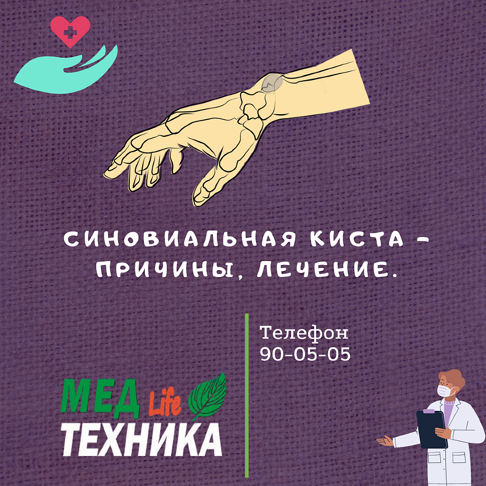 Синовиальная киста – причины и варианты лечения