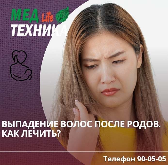 Выпадение волос после родов. Как лечить?