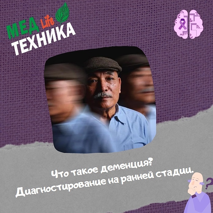 Что такое деменция? Диагностирование на ранней стадии.
