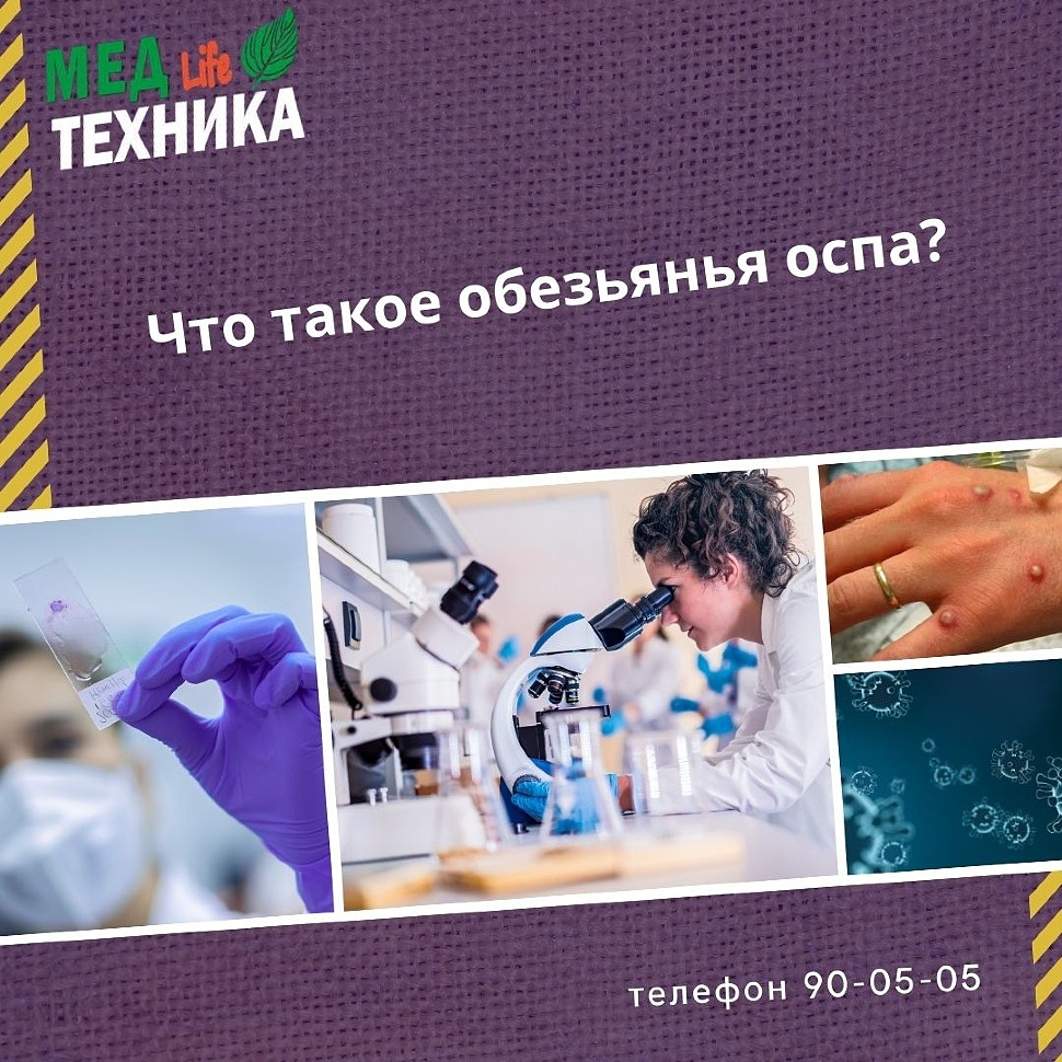 Что такое обезьянья оспа?
