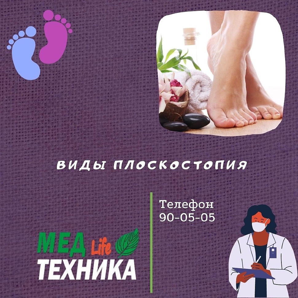 Виды плоскостопия