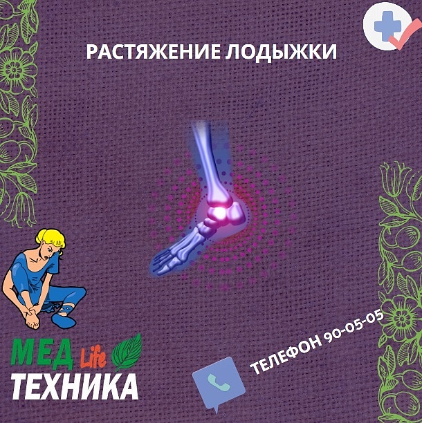 Растяжение лодыжки