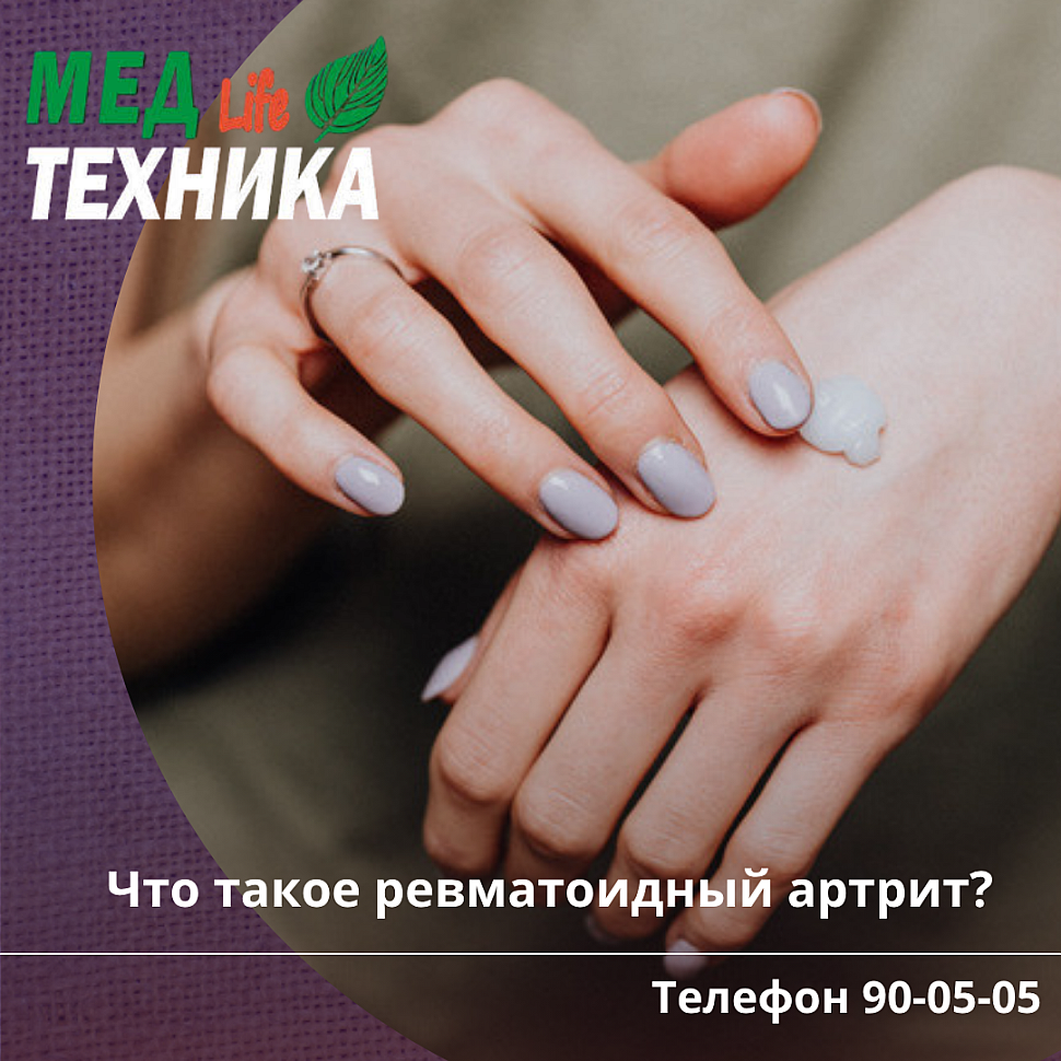 Что такое ревматоидный артрит? Основные причины возникновения.