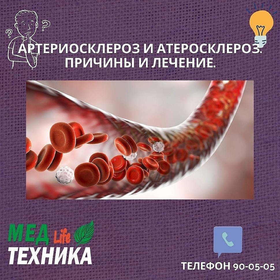 Артериосклероз и Атеросклероз. Причины и лечение.