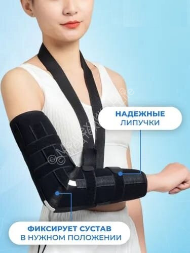 Замена гипса на локтевой сустав при переломах (3 металлических ребра)